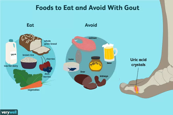 How to Naturally Lower Your Uric Acid Levels with Food