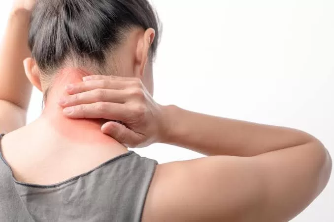 Fibromyalgia: What You Need to Know and 10 Natural Remedies